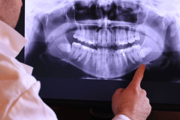 Best Emergency TMJ Treatment in Seville, OH