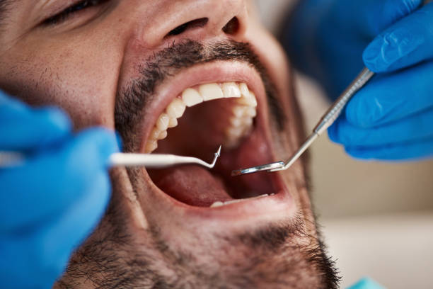 Fast & Reliable Emergency Dental Services in OH