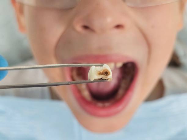 Best Emergency Denture Repair in Seville, OH